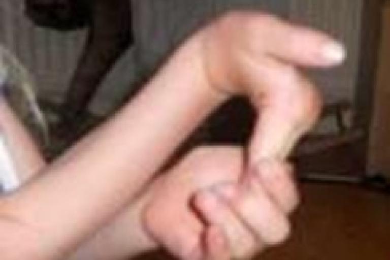 Child bending her fingers back